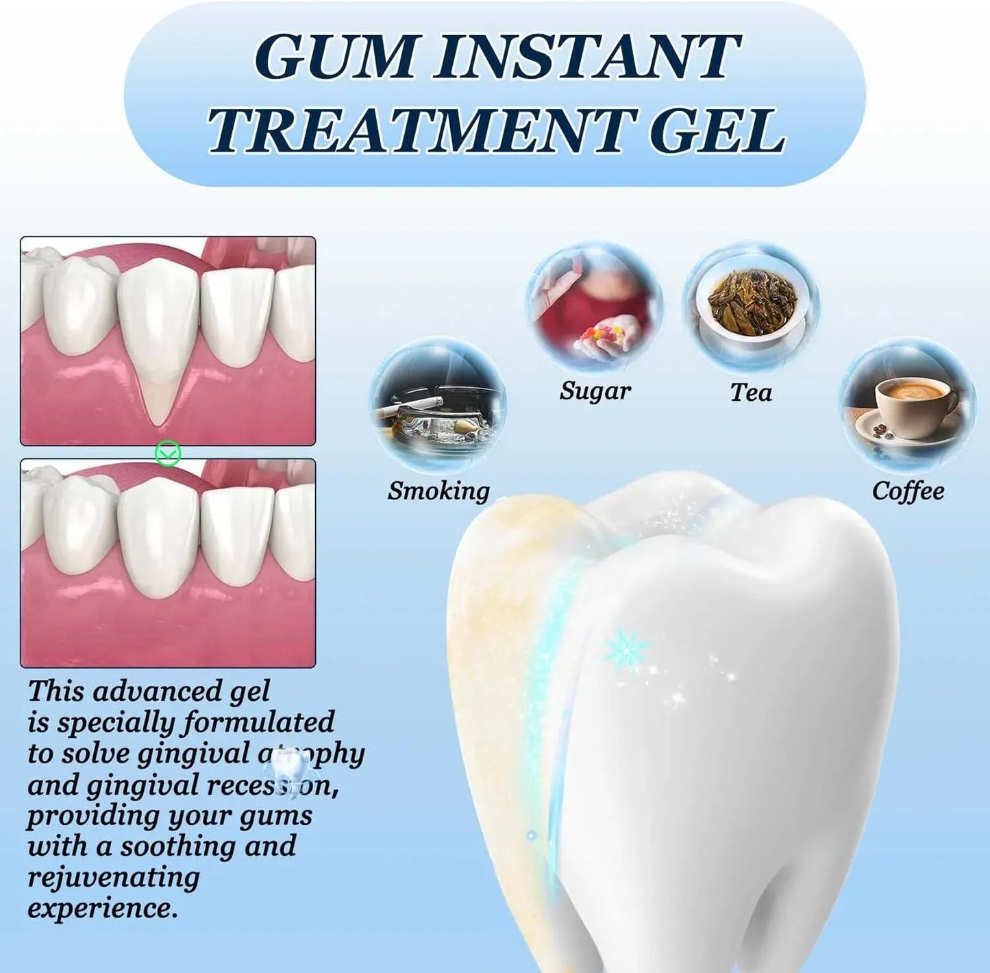 Daily Gum Gel